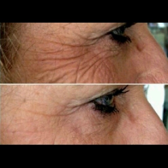 Luminesce Instantly Ageless✨✨10 packets .3 ml each - Picture 3 of 6